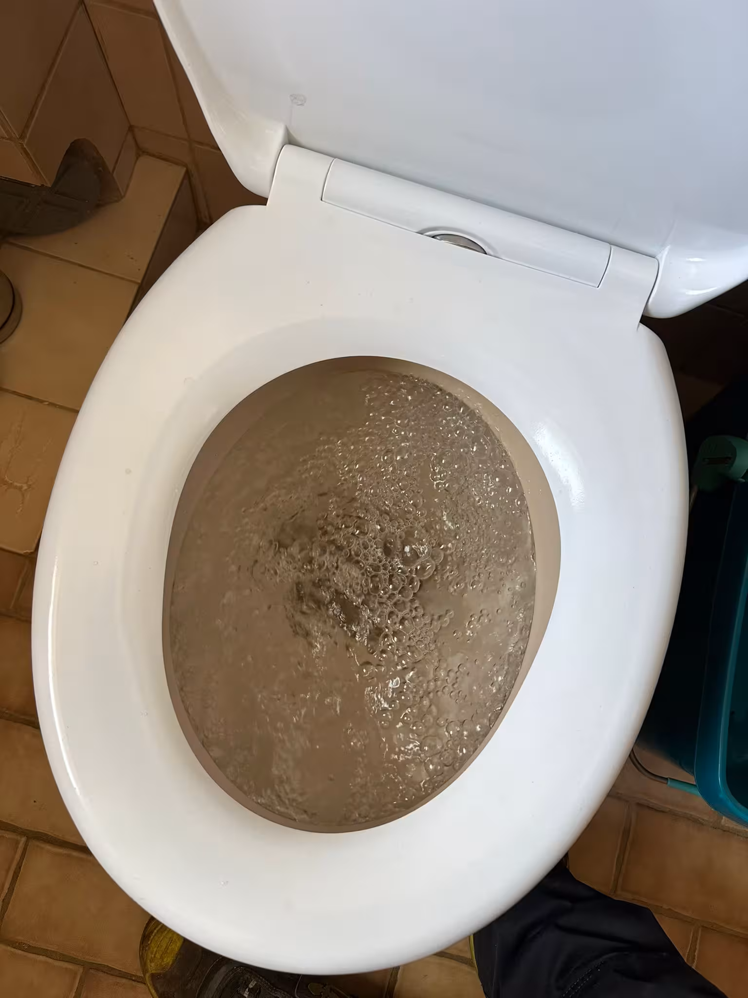 Verstopfte Toilette mit akutem Rückstau – Notfall für die schnelle Rohrreinigung durch PipeHero Hamburg